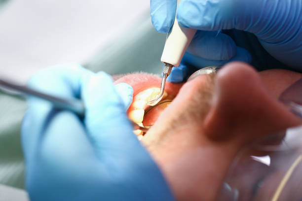 Best Emergency Tooth Extraction  in Slayton, MN